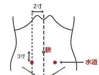 艾灸2个穴位3天就可让水肿的肚子消下去——《针通经络》之四