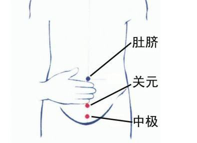 艾灸2个穴位3天就可让水肿的肚子消下去——《针通经络》之四